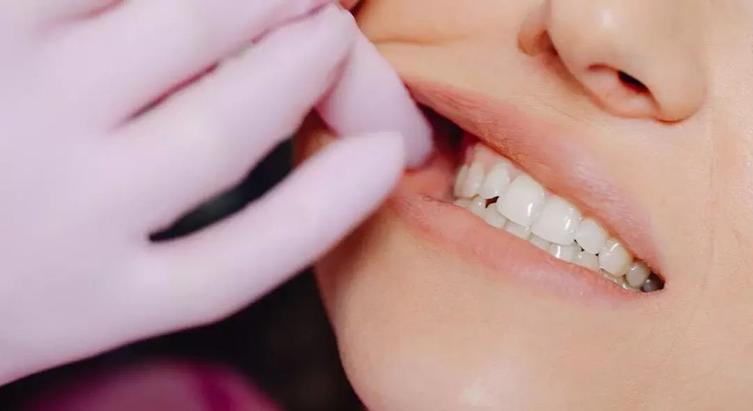 Overbite In Teeth Symptoms, Causes & Treatment